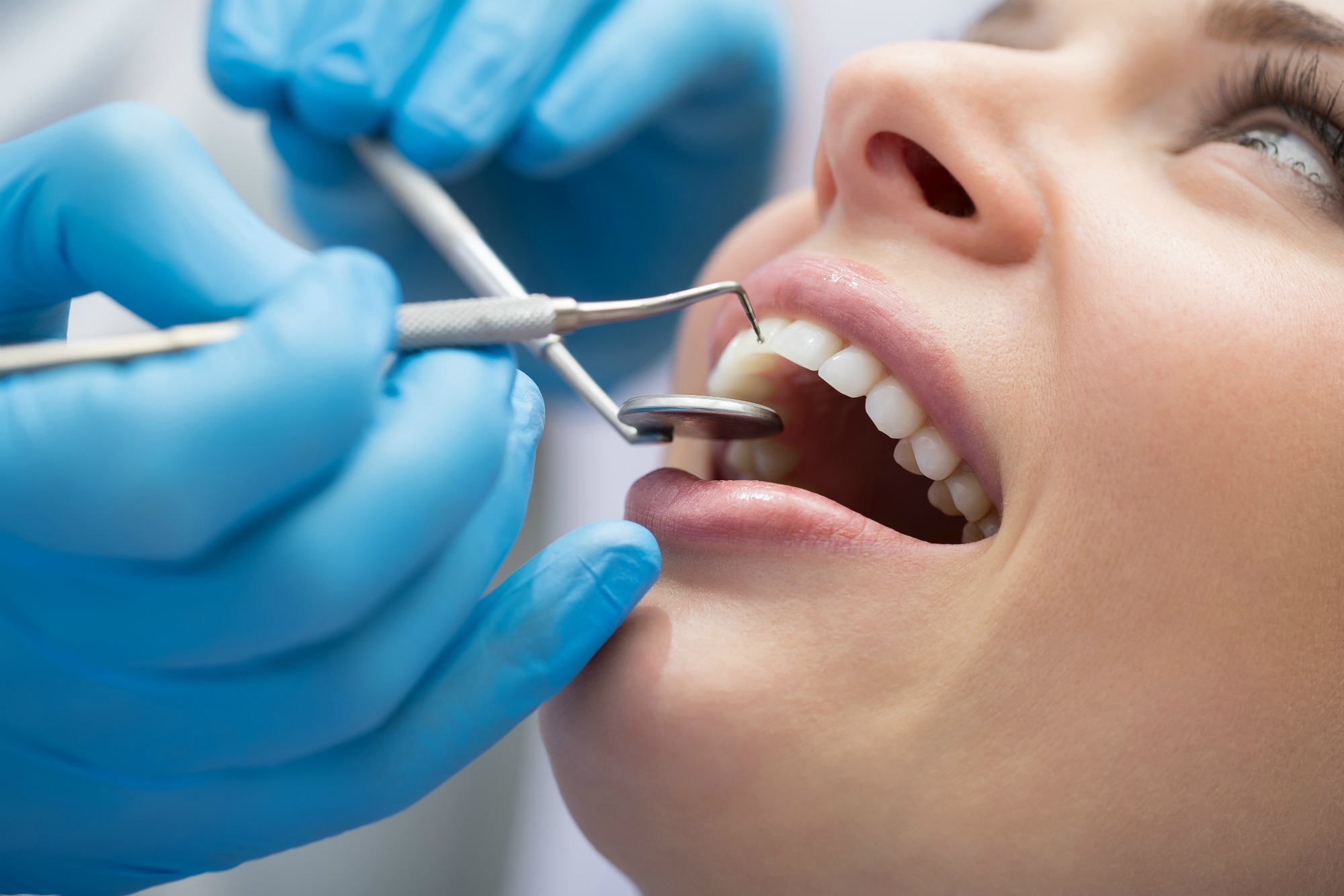 dental-exam-4