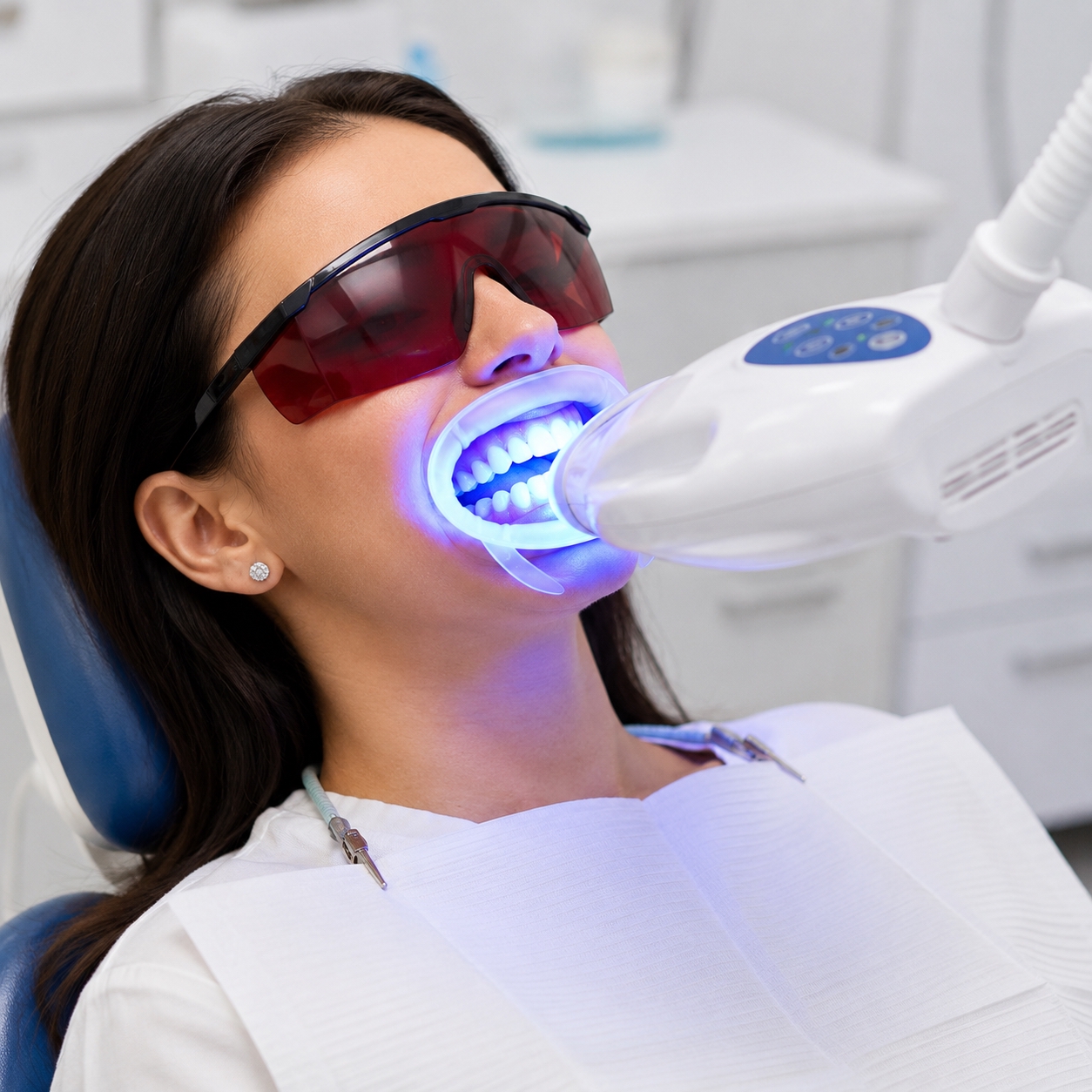 inoffice-teeth-whitening-1